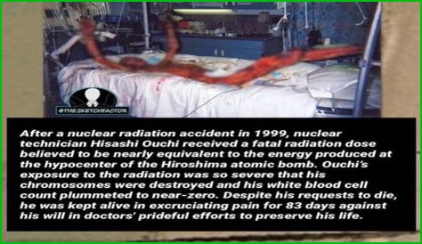**The Remarkable Journey Of Hisachi Ouchi After Radiation**
